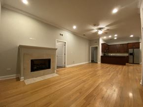 Chicago apartment for rent - Fireplace in the living room - 3 Bedroom